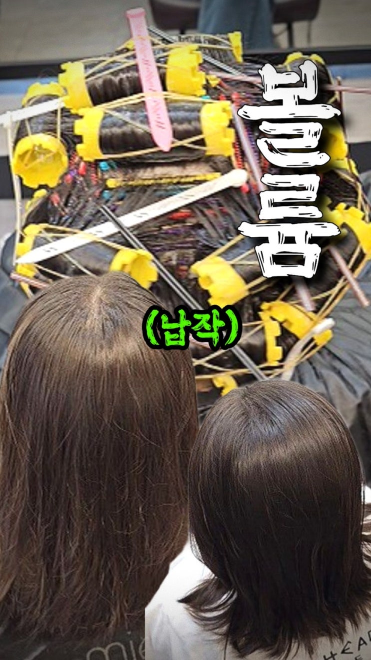  링거펌으로 해결한 40대 여성 가르마 갈라짐 & 납작 두상 고민
