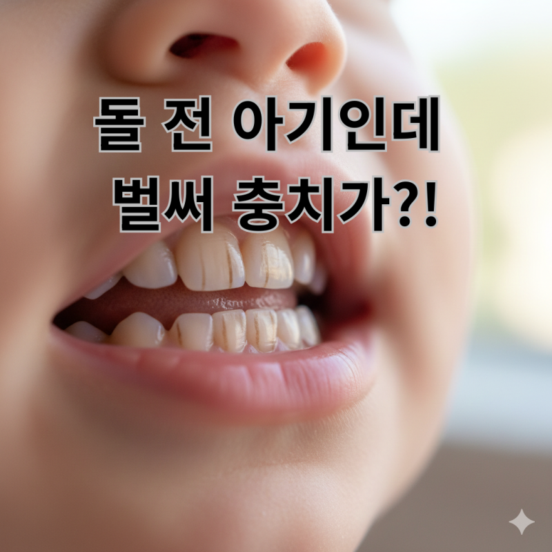 돌 전 아기 충치 가능할까? 치아에 생긴 이상한 줄과 소아치과 진단 후기