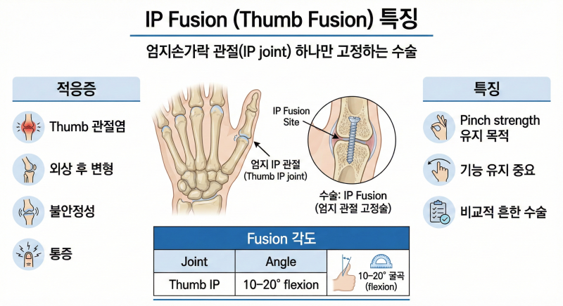 손가락 DIP PIP IP Fusion 차이 완벽 정리① (수술실 간호사 필수 지식) : 네이버 블로그
