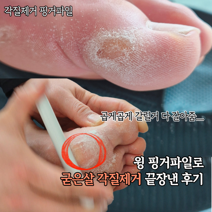  무자극 각질제거 wing 핑거파일 슥슥 밀어서 각질 굳은살 끝장낸 후기