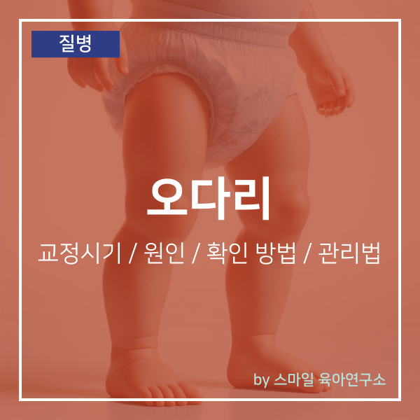 아기 오다리 교정시기 및 원인과 증상 확인 방법