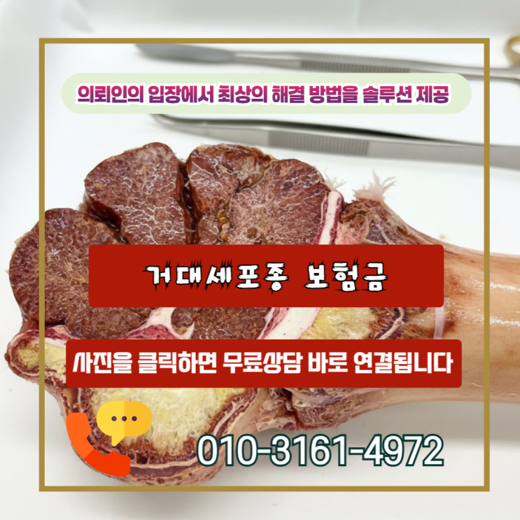  거대세포종 보험금, D21.9 양성인데 왜 수천만 원이 달라질까?