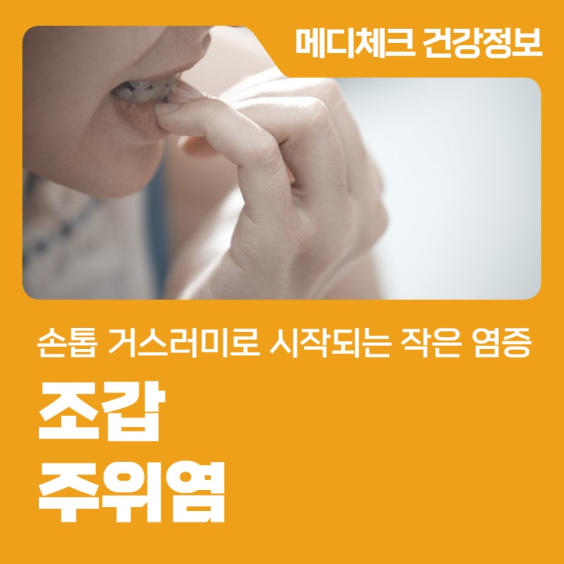 손톱 거스러미로 시작되는 작은 염증, 조갑주위염
