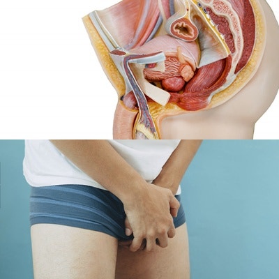 정계정맥류수술병원 남성을 위해서라면