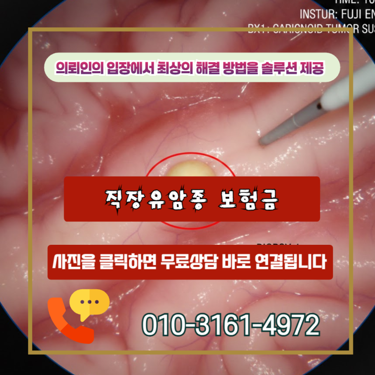  직장유암종 보험금, 소액 지급 통보받았다면? 전액 수령을 위한 손해사정사의 실전 전략