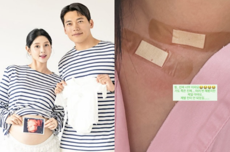 “6기 영철 아내 영숙, 갑상선암 투병 고백…‘목감기인 줄 알았는데 너무 아파요’”
