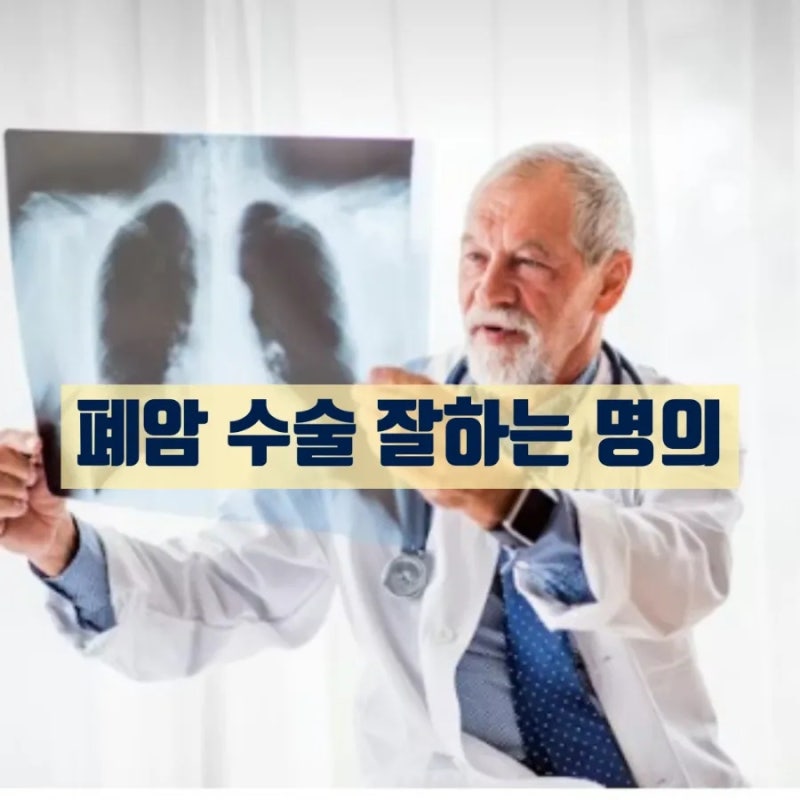 [암 정복 시리즈] 폐암 수술 전 꼭 알아 할 명의 리스트