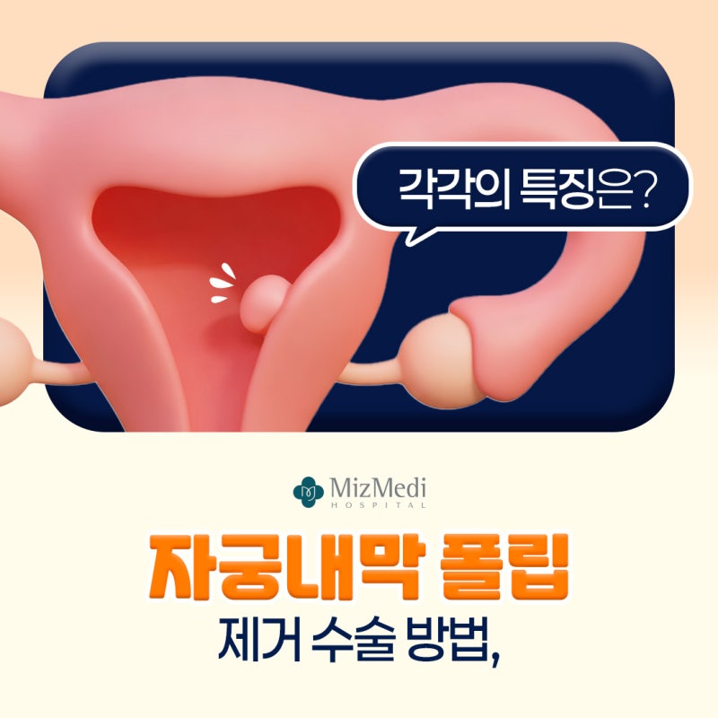 자궁내막폴립 제거 수술 방법, 각각의 특징은?