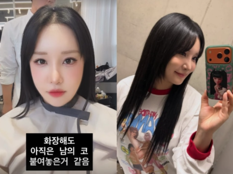 랄랄 성형 수술 후 "안색도 밝아졌다"…달라진 근황 공개