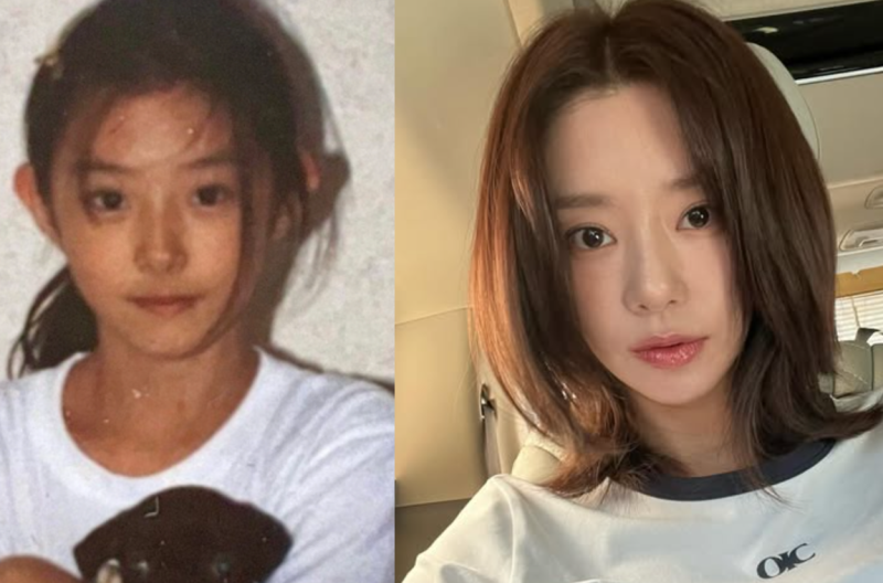 "성형이라고요?" 이주빈 어릴 때 사진 한 장에 논쟁 끝… 이 습관 안 하면 30대에 확 늙습니다