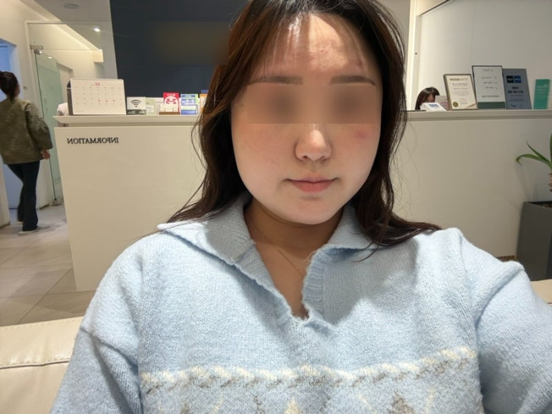 웨딩 촬영 앞두고 온다리프팅 내돈내산 후기 — 강남 가성비 찐 경험담