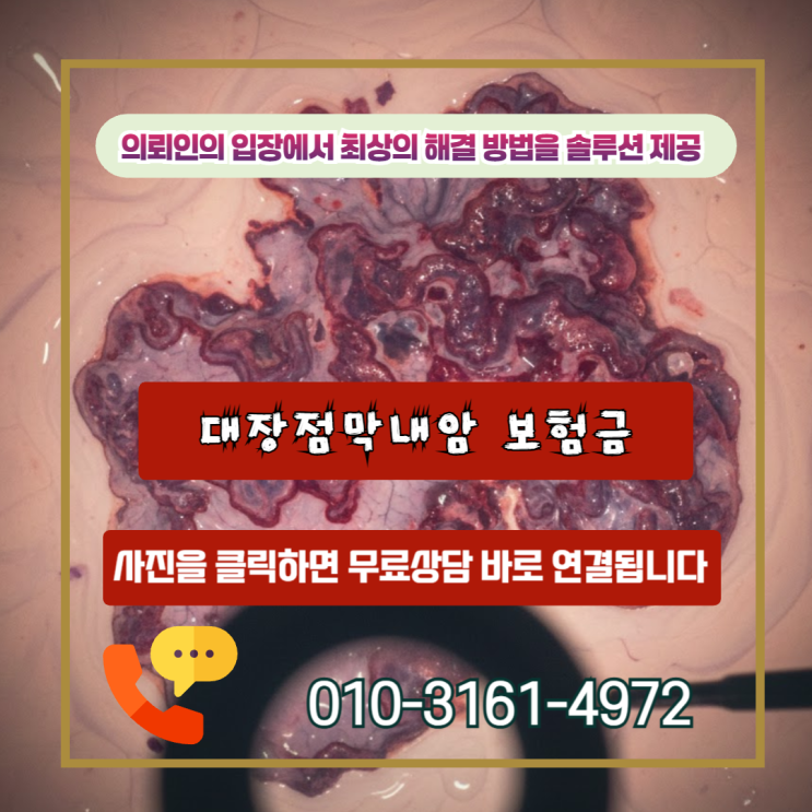  대장점막내암 보험금, D01 코드 하나 차이로 수 천만원이 달라집니다