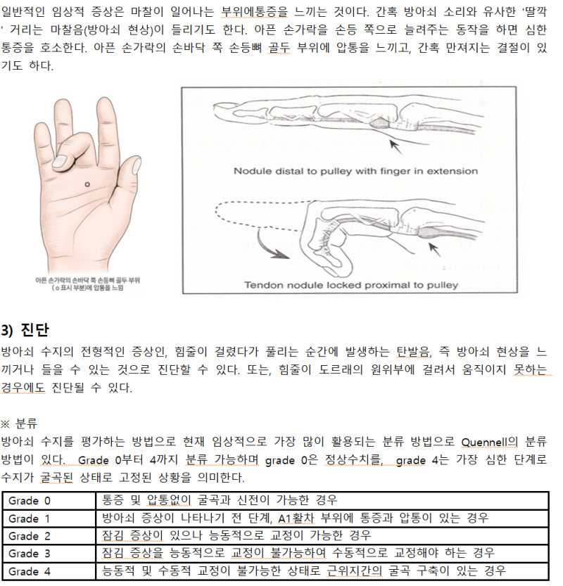 Trigger Finger Release 수술 완벽정리 ②(수술실 신규 간호사 필수) : 네이버 블로그