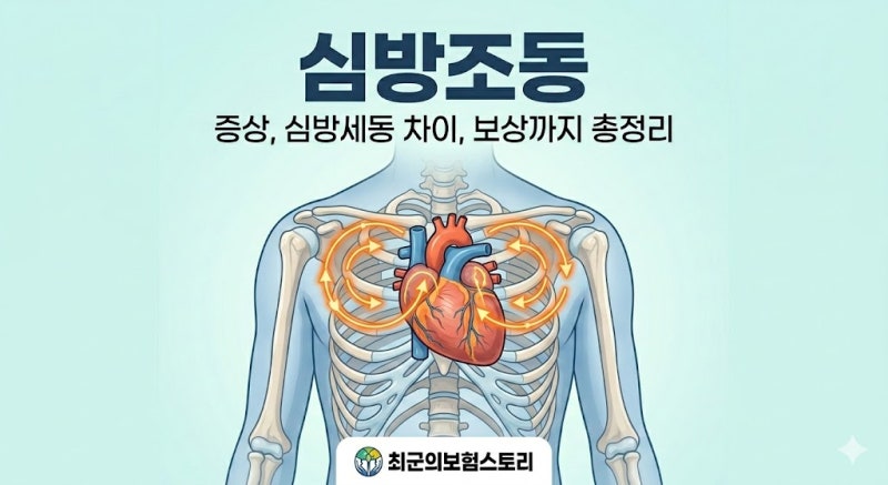 심방조동 증상과 심방세동 차이점 I48 질병코드 실비 보상 및 산정특례 기준