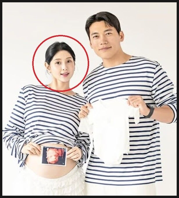  나솔 6기 영숙 갑상선암 투병 고백 "목감기인 줄 알았는데.." 안타까운 근황과 전조증상