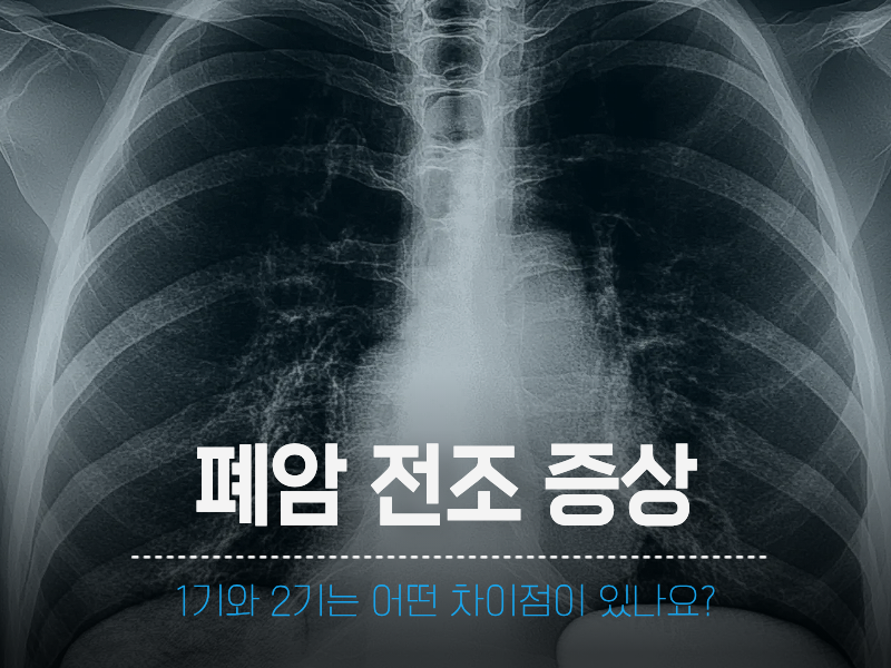 폐암 전조 증상 1기, 2기 차이점 & 저선량 흉부 CT 필요성