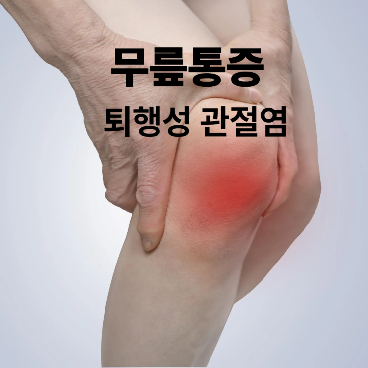  수곡동 무릎통증 참는 게 답일까요? 퇴행성관절염 통증주사 1세대의 지혜