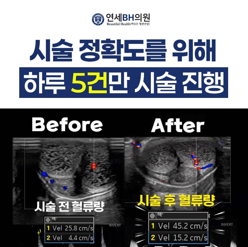 치매치료제가격 비용보다 중요한 건 [기억 유지 가능성]
