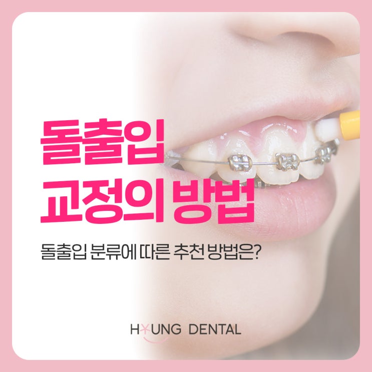  수원영통치과가 말하는 돌출입 교정 방법