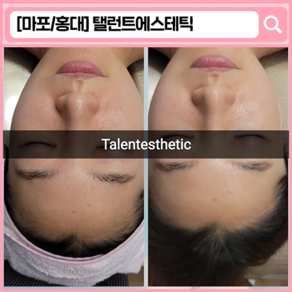 '탤런트에스테틱' 홍대피부관리, 홍대에스테틱, 홍대신부관리