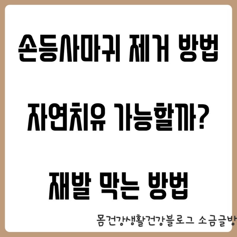 손등사마귀 원인 제거 치료ㅣ전염될까? 재발 방지