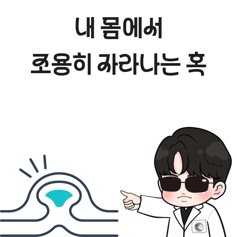 인천 표피낭종 , 피지낭종제거에 대해서 알아봐요 인천피부표피낭종수술 ~