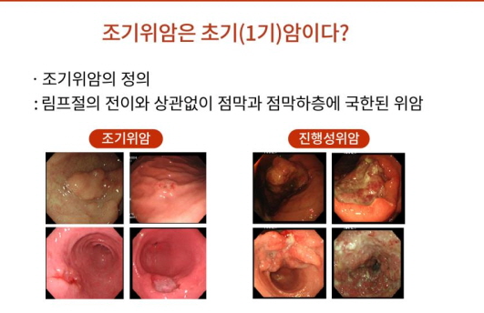 과민성대장증후군영양제 효과 및 선택 방법