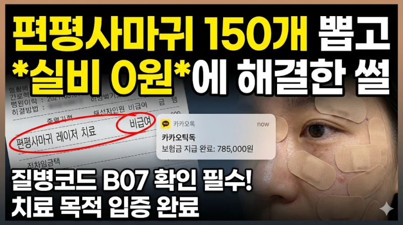 2026 편평사마귀 실비 청구 성공기: 150개 제거하고 보험금 받은 비결 (B07 코드)