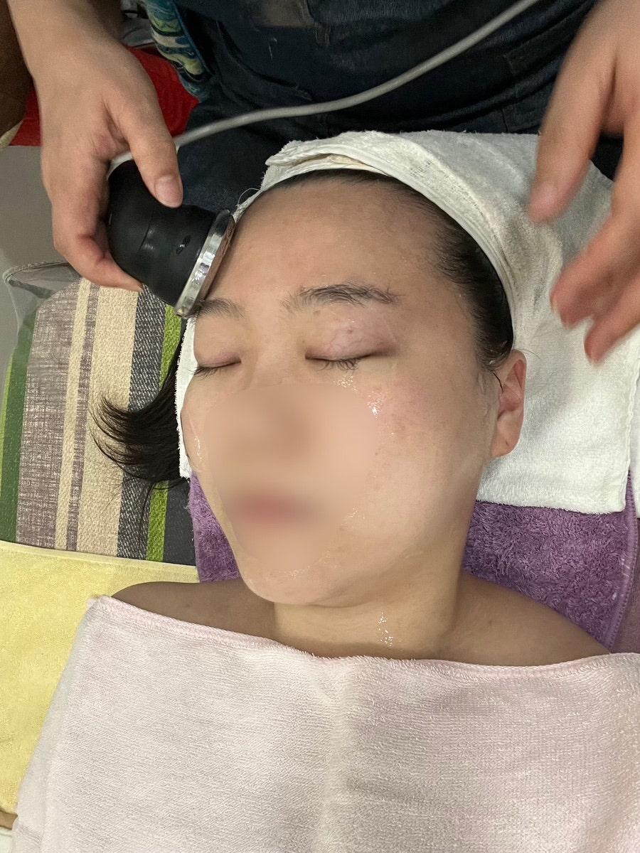 아카 사진 6