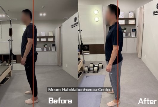  학익동 재활만성 허리통증 원인부터 해결