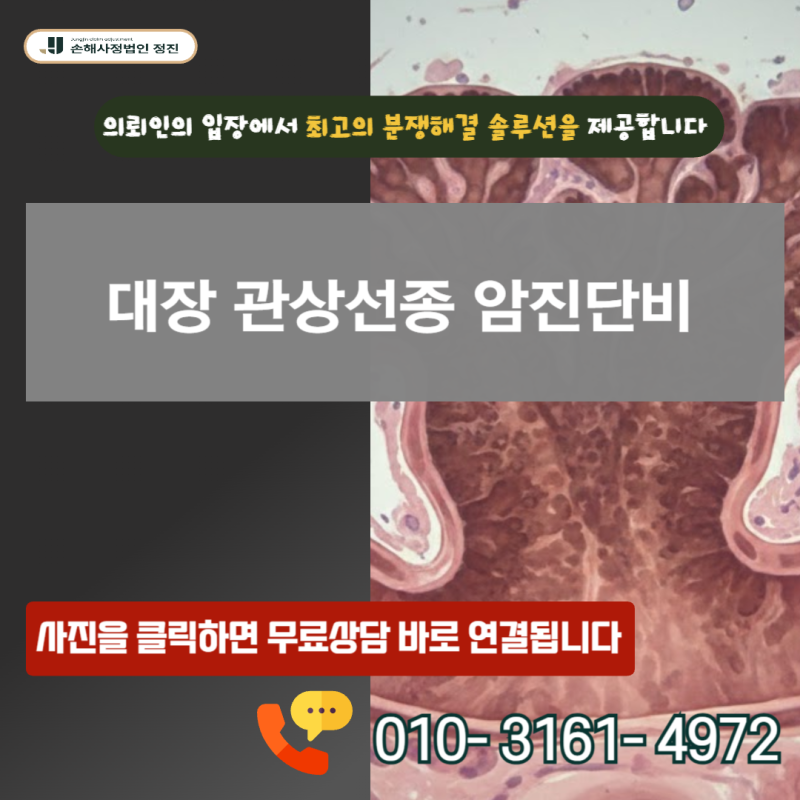 대장 관상선종 암보험금, D12라도 전액 받는 결정적 한 줄
