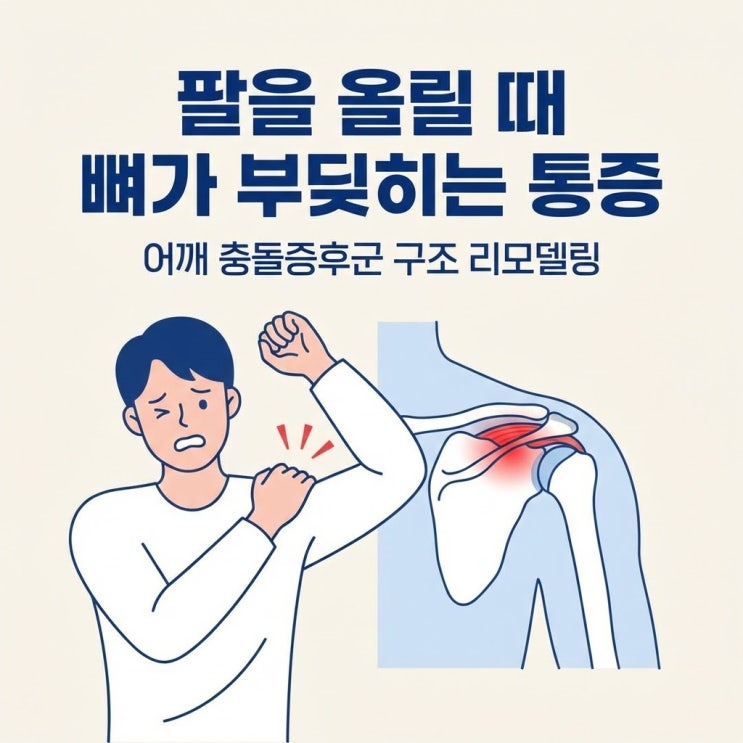 팔을 올릴 때 뼈가 부딪히는 통증, 어깨 충돌증후군 리모델링