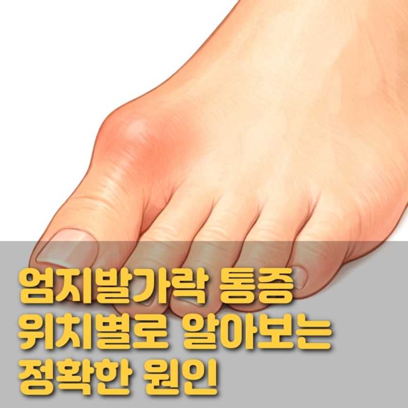 엄지발가락 바닥·끝·옆·관절 통증,위치별로 알아보는 정확한 원인