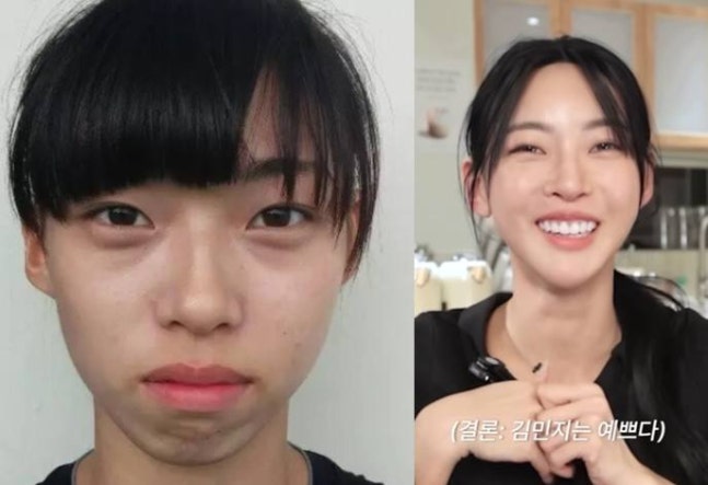  김민지 과거사진 충격? 성형 의혹에 직접 해명 “진짜 안 했다”…이렇게 예뻐질 줄 몰랐다 고백