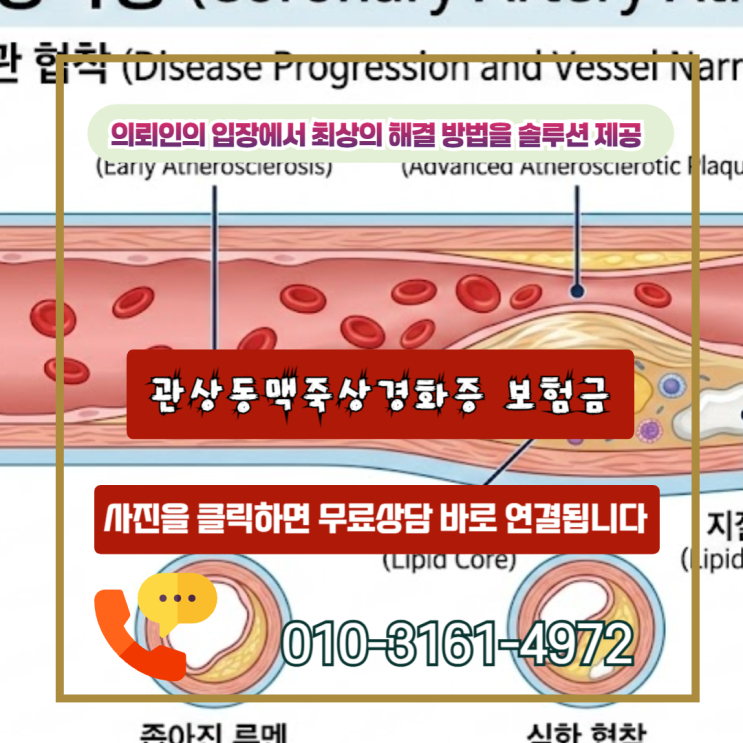  관상동맥죽상경화증 보험금, 거절 통보? 협착률 50% 입증으로 수천만 원 지키는 법