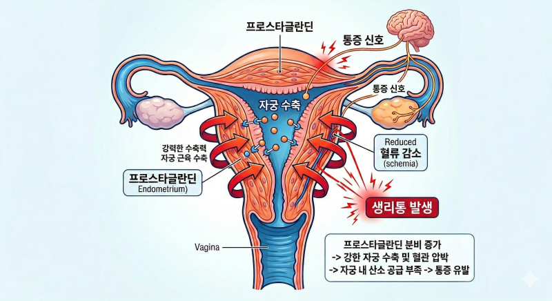 매달 반복되는 생리통, 진통제 '내성'과 '부작용'이 걱정되기 시작했다면?