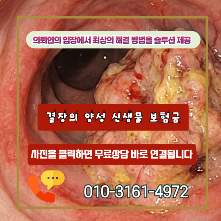  결장의 양성 신생물 보험금, D12.6 받아도 제자리암 지급되는 숨겨진 이유!