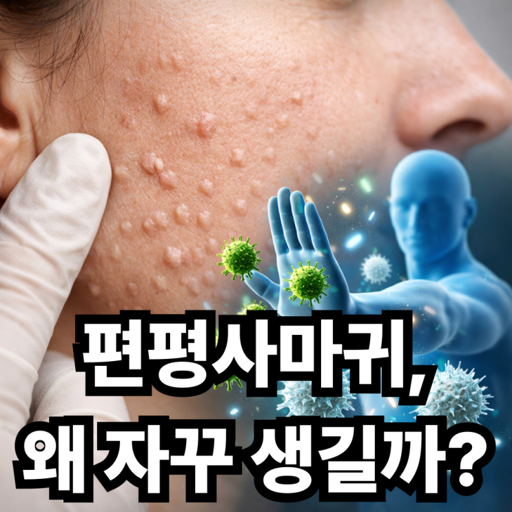  편평사마귀 면역력과의 관계, 왜 자꾸 생길까? 원인부터 해결까지