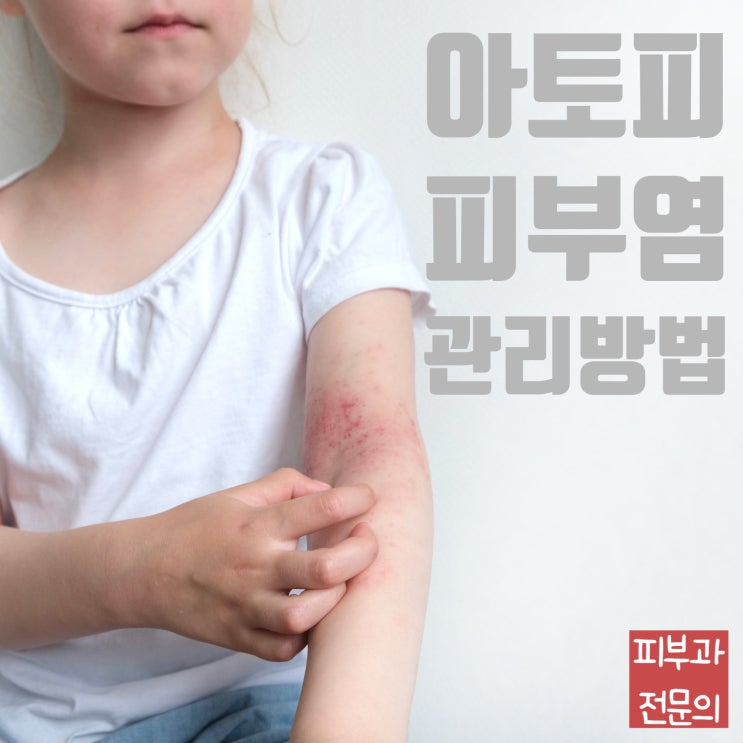  아토피피부염의 관리방법 (원인인자피하기/환경관리/보습)