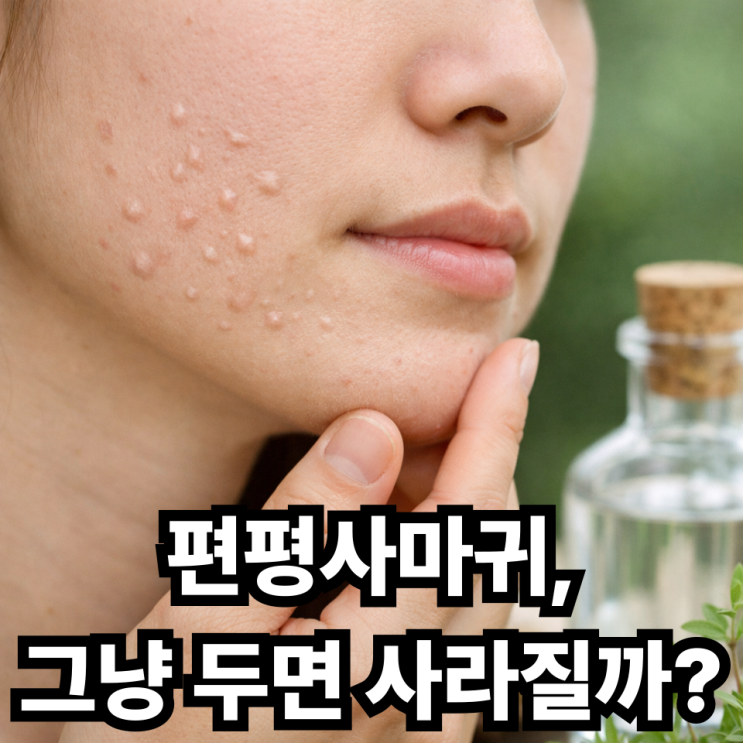  편평사마귀 자연치유 가능할까? 기다려도 괜찮은 기준 정리