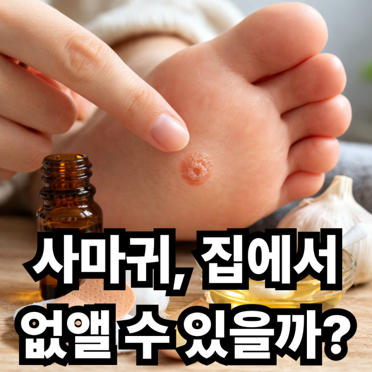  편평사마귀 홈케어 가능할까? 민간요법의 위험성까지 제대로 알기