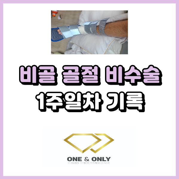  비골 골절 비수술 보존치료 1주차 기록