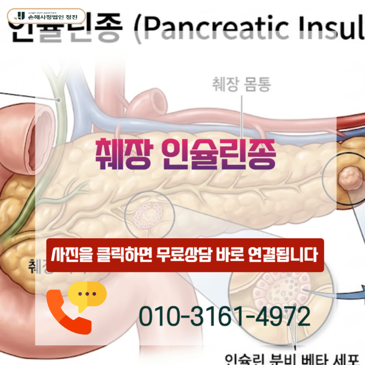  췌장 인슐린종, D13.7 코드라도 암진단비 100% 받을 수 있을까?