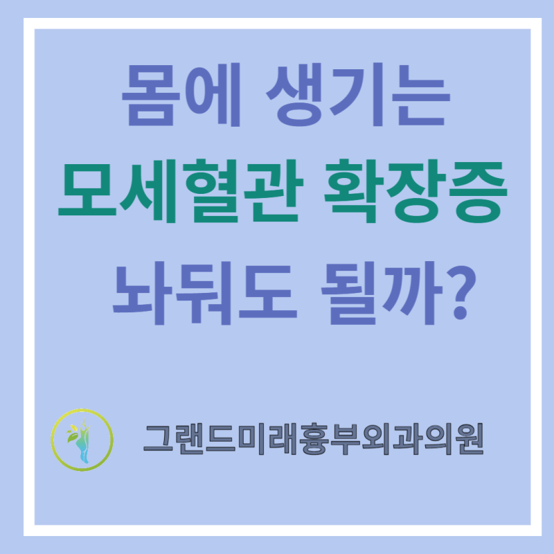 다리가 아닌 몸에 생기는 모세혈관 확장, 방치해도 될까?