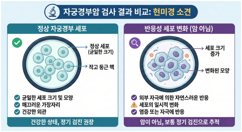 자궁경부암 검사 결과 : 반응성 세포 변화, 위축성 질염, 비정형 상피세포? 흔히 볼 수 있는 ....