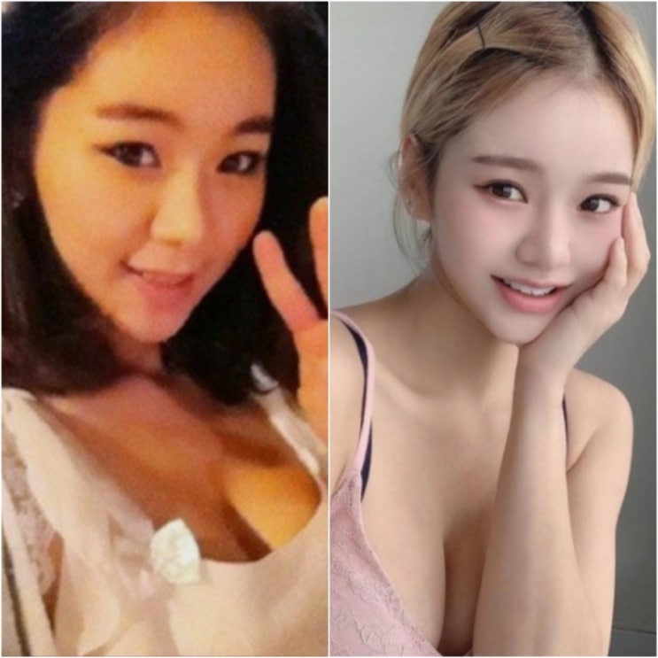  '한 번 하는데 5억 줄게' 거액 스폰서 제안 고백한 여배우 엉덩이뽕 성형 논란
