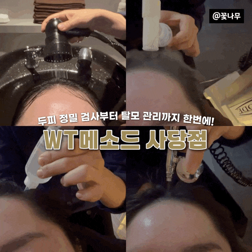  이수 탈모 고민 헤어라인 정밀 검사부터 두피 관리까지 받은 WT메소드 후기
