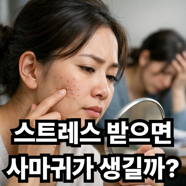  편평사마귀와 스트레스  정말 연관이 있을까?