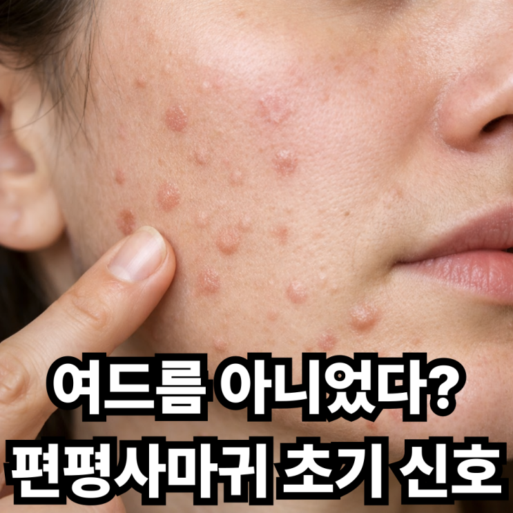  편평사마귀 초기 증상  놓치기 쉬운 신호 총정리