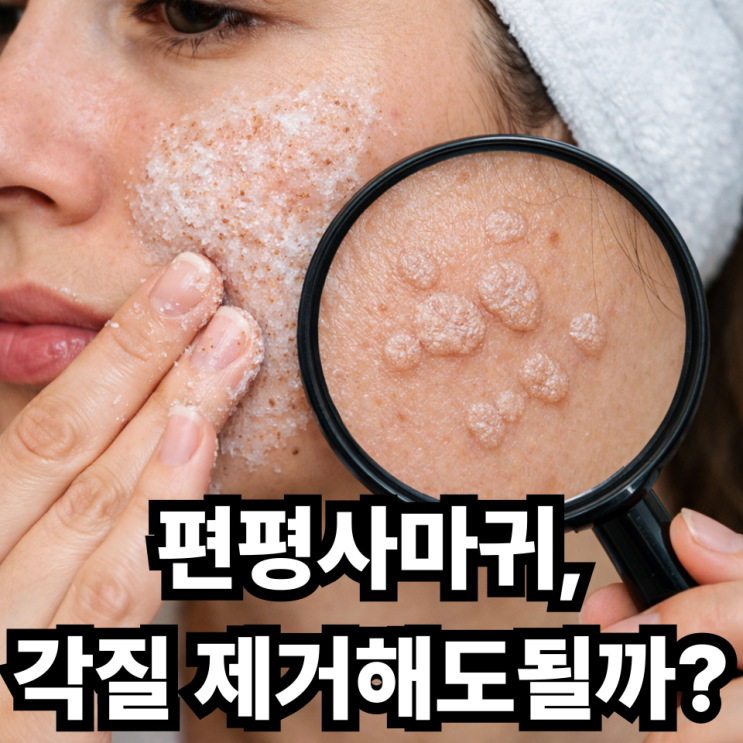  편평사마귀 각질제거해도 될까? 피부과 전문의가 말하는 진짜 답